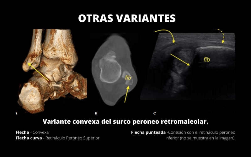 Resonancia magnetica y ecografia.png